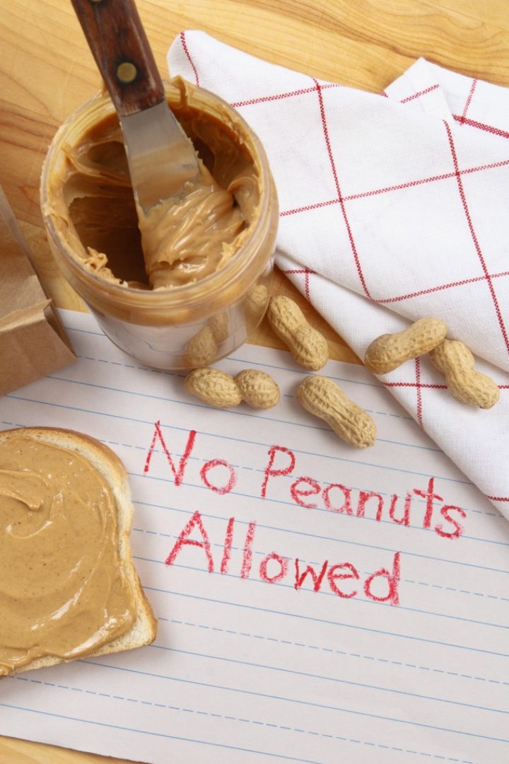 Foodallergies