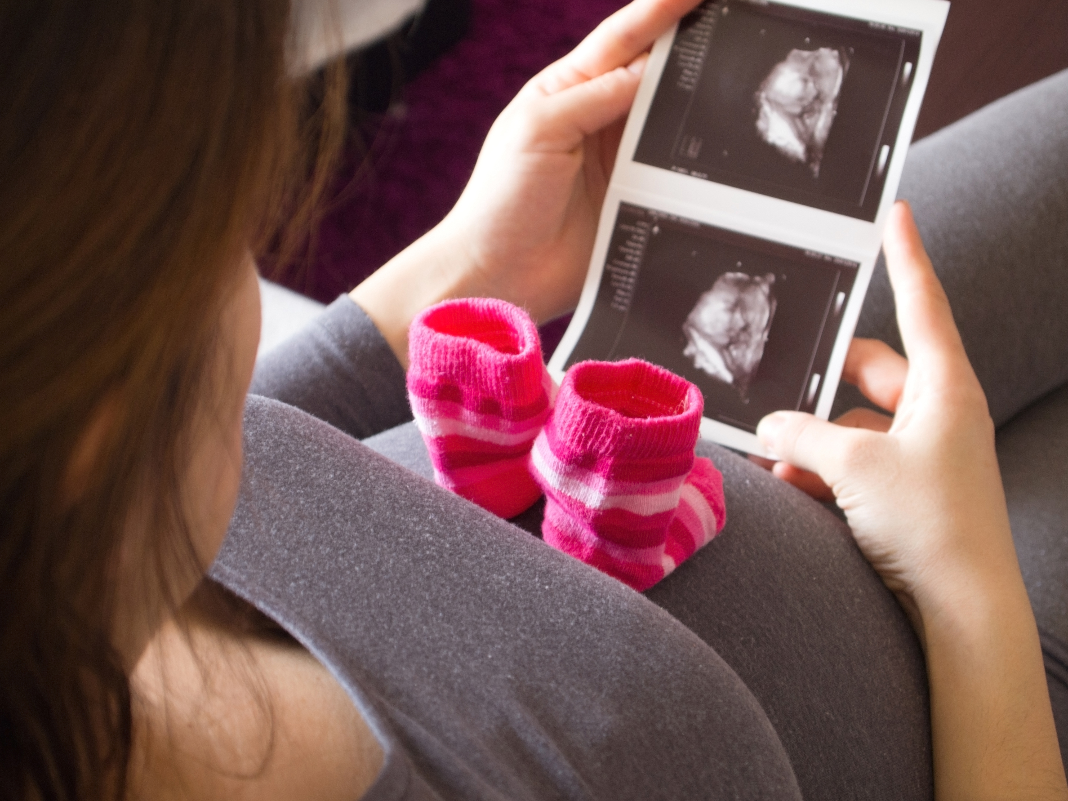 Pregnant woman looking x-ray picture of baby